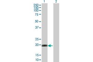 Western Blot analysis of CETN1 expression in transfected 293T cell line by CETN1 MaxPab polyclonal antibody. (Centrin 1 anticorps  (AA 1-172))