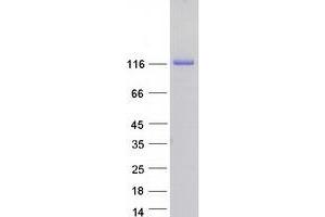 Validation with Western Blot