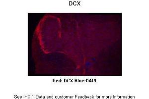Sample Type :  Mouse spinal cord  Primary Antibody Dilution :  1:300  Secondary Antibody :  Anti-rabbit-Alexa 594  Secondary Antibody Dilution :  1:500  Color/Signal Descriptions :  Red: DCX Blue:DAPI  Gene Name :  DCX  Submitted by :  Anonymous (Doublecortin anticorps  (C-Term))