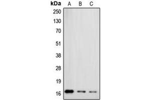 Western blot analysis of Gamma-synuclein expression in MCF7 (A), HT29 (B), HeLa (C) whole cell lysates.