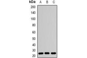 Western blot analysis of RAB5A expression in Hela (A), PC12 (B), mouse brain (C) whole cell lysates. (RAB5 anticorps)