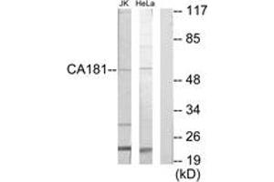 Western blot analysis of extracts from Jurkat/HeLa cells, using CA181 Antibody. (CA181 (AA 301-350) anticorps)