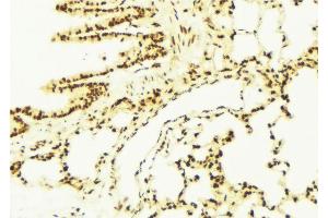 ABIN6273091 at 1/100 staining Mouse lung tissue by IHC-P. (ALDH7A1 anticorps  (C-Term))