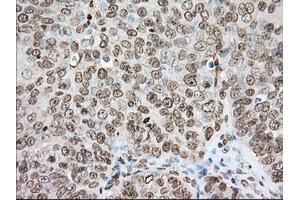 Immunohistochemical staining of paraffin-embedded Human colon tissue using anti-CYP1A2 mouse monoclonal antibody. (CYP1A2 anticorps)
