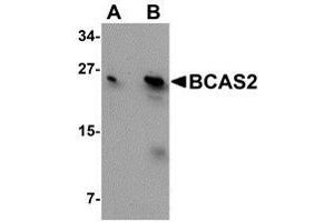 Western blot analysis of BCAS2 in MCF7 cell lysate with AP30126PU-N BCAS2 antibody at (A) 0.