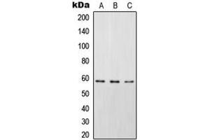 Western blot analysis of STAM2 (pY192) expression in HEK293T EGF-treated (A), SP2/0 EGF-treated (B), rat spleen (C) whole cell lysates.