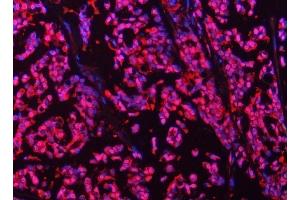 IF analysis of PSMB4 using anti-PSMB4 antibody (ABIN7600532).
