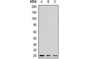 Western blot analysis of Alpha-crystallin A expression in mouse kidney (A), mouse liver (B), mouse heart (C) whole cell lysates. (CRYAA anticorps)