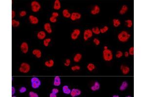 Confocal immunofluorescence analysis of Hela cells using METTL3 Polyclonal Antibody at dilution of 1:200.