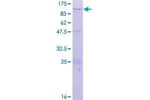 Image no. 1 for Zinc Finger Protein 84 (ZNF84) (AA 1-738) protein (GST tag) (ABIN1326466)