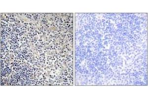 Immunohistochemistry (IHC) image for anti-P53-Regulated Apoptosis-Inducing Protein 1 (TP53AIP1) (AA 75-124) antibody (ABIN2890029) (TP53AIP1 anticorps  (AA 75-124))