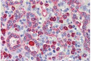 Human Spleen (formalin-fixed, paraffin-embedded) stained with NR2C1 antibody ABIN462209 followed by biotinylated goat anti-rabbit IgG secondary antibody ABIN481713, alkaline phosphatase-streptavidin and chromogen.