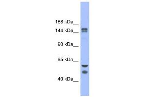 WB Suggested Anti-FBXL10 Antibody Titration: 0. (KDM2B anticorps  (Middle Region))
