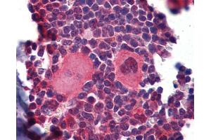 IHC Information: Paraffin embedded mouse lymphoid tissue (skeletal muscle) tissue, tested with an antibody dilution of 5 ug/ml. (NK2 Homeobox 3 anticorps  (C-Term))