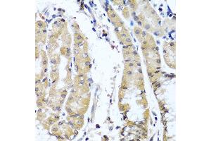 Immunohistochemistry of paraffin-embedded human stomach using COL9A1 antibody at dilution of 1:100 (40x lens). (COL9A1 anticorps)