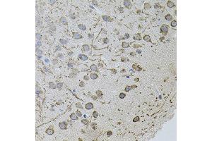 Immunohistochemistry of paraffin-embedded mouse brain using AR antibody.