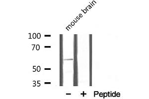 Western blot analysis on mouse brain lysate using Osteopontin Antibody