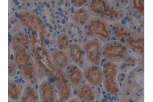 DAB staining on IHC-P; Samples: Rat Kidney Tissue (CUBN anticorps  (AA 3511-3623))