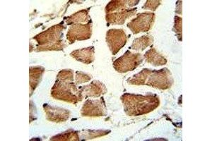 IHC analysis of FFPE human skeletal muscle stained with TAZ antibody