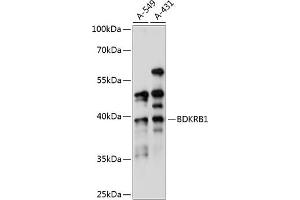 Western blot analysis of extracts of various cell lines, using BDKRB1 antibody (ABIN7265910) at 1:1000 dilution.