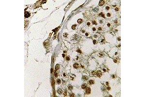 Immunohistochemical analysis of CIRBP staining in human testis formalin fixed paraffin embedded tissue section.