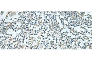 Immunohistochemistry of paraffin-embedded Human tonsil tissue using SHTN1 Polyclonal Antibody at dilution of 1:60(x200) (Shootin-1 (SHTN1) anticorps)