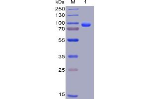 Human CD138, hFc-His Tag on SDS-PAGE under reducing condition.