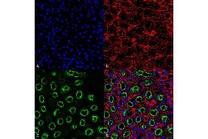 Immunohistochemistry analysis using Rabbit Anti-NKCC2 Polyclonal Antibody (ABIN2486317).