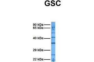 Host:  Rabbit  Target Name:  GSC  Sample Tissue:  Human DLD1  Antibody Dilution:  1.