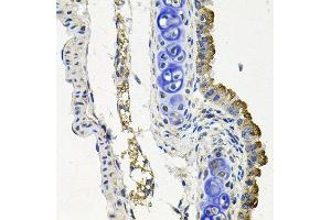 Immunohistochemistry of paraffin-embedded mouse lung using MARK1 antibody at dilution of 1:100 (x40 lens). (MARK1 anticorps)