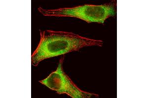 Fluorescent image of Hela cell stained with TEC Antibody (Center) (ABIN392111 and ABIN2841862).