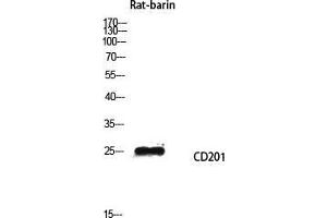 Western Blot (WB) analysis of Rat barin lysis using CD201 antibody. (PROCR anticorps  (Internal Region))