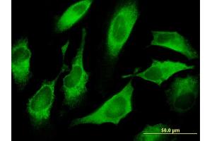Immunofluorescence of monoclonal antibody to CDS1 on HeLa cell.