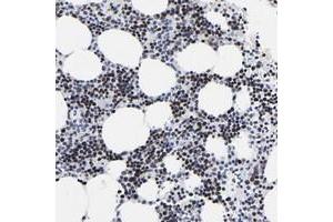 Immunohistochemical staining of human bone marrow with ZNF589 polyclonal antibody  shows strong nuclear positivity in bone marrow poietic cells. (ZNF589 anticorps)
