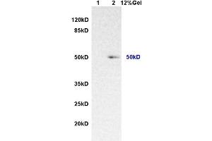 Lane 1: rat lung lysates Lane 2: human colon carcinomalysates probed with AntiIL-7Ra/CD127 Polyclonal Antibody, Unconjugated (ABIN731063) at 1:200 in 4 °C. (IL7R anticorps  (AA 251-350))