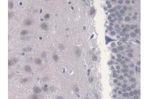 DAB staining on IHC-P; Samples: Rat Cerebrum Tissue