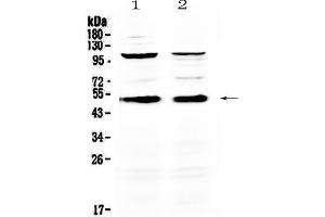 Western blot analysis of CD14 using anti-CD14 antibody .