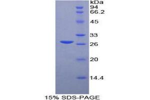 SDS-PAGE (SDS) image for Matrix Metalloproteinase 2 (MMP2) (AA 445-660) protein (His tag) (ABIN1080271)