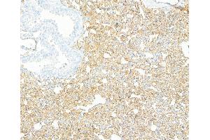 Immunohistochemistry (IHC) image for anti-Cadherin 5 (CDH5) (AA 25-595) antibody (ABIN7453992) (Recombinant Cadherin 5 anticorps  (AA 25-595))