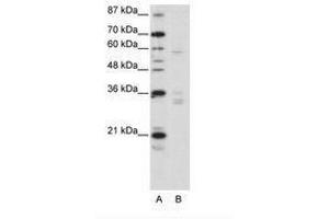 Image no. 1 for anti-Zinc Finger Protein 440 (ZNF440) (N-Term) antibody (ABIN203220) (ZNF440 anticorps  (N-Term))