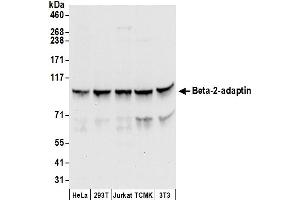 Western Blotting (WB) image for anti-Adaptor-Related Protein Complex 2, beta 1 Subunit (AP2B1) (AA 575-625) antibody (ABIN7450026)