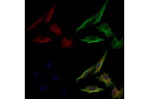 ABIN6264566 and ABIN6279733 staining 3 by IF/ICC. (RAB24 anticorps  (Internal Region))