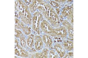 Immunohistochemistry of paraffin-embedded rat kidney using DLAT antibody (ABIN7266768) at dilution of 1:100 (40x lens).