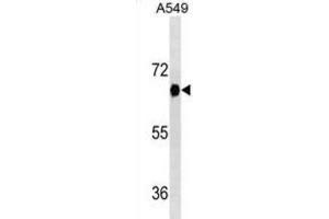 Western Blotting (WB) image for anti-Dual-Specificity tyrosine-(Y)-phosphorylation Regulated Kinase 2 (DYRK2) antibody (ABIN2995437) (DYRK2 anticorps)
