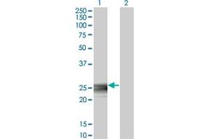 Western Blot analysis of RAB3B expression in transfected 293T cell line by RAB3B monoclonal antibody (M01A), clone 3F12. (RAB3B anticorps  (AA 120-219))