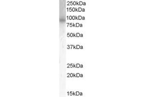 Image no. 1 for anti-phosphodiesterase 4B, cAMP-Specific (PDE4B) (C-Term) antibody (ABIN374649) (PDE4B anticorps  (C-Term))