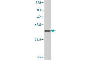 Western Blot detection against Immunogen (36. (TRIP6 anticorps  (AA 51-148))