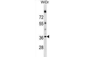 Western Blotting (WB) image for anti-Asparagine-Linked Glycosylation 5, Dolichyl-Phosphate beta-Glucosyltransferase Homolog (S. Cerevisiae) (ALG5) antibody (ABIN2999771) (ALG5 anticorps)