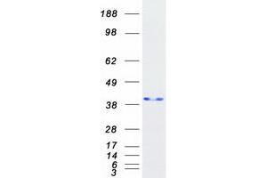 Validation with Western Blot