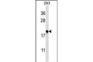 Western blot analysis in 293 cell line lysates (35ug/lane). (EMC4 anticorps  (N-Term))